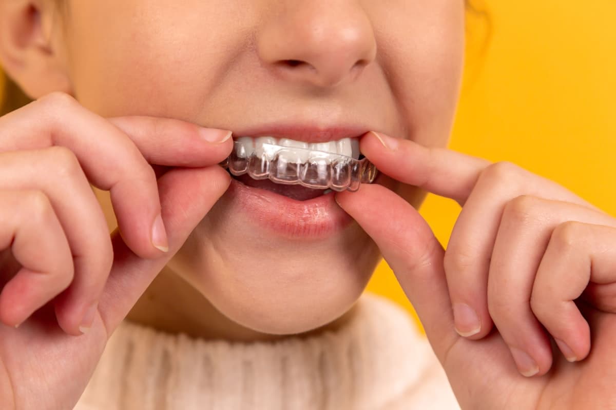 Cosmetic & Veneers